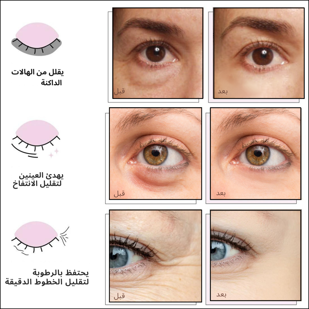 Evonex® Rejuvenating Eye™ Masks