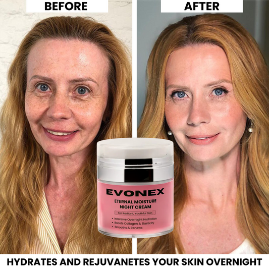 Evonex® Eternal Moisture™ Night Cream